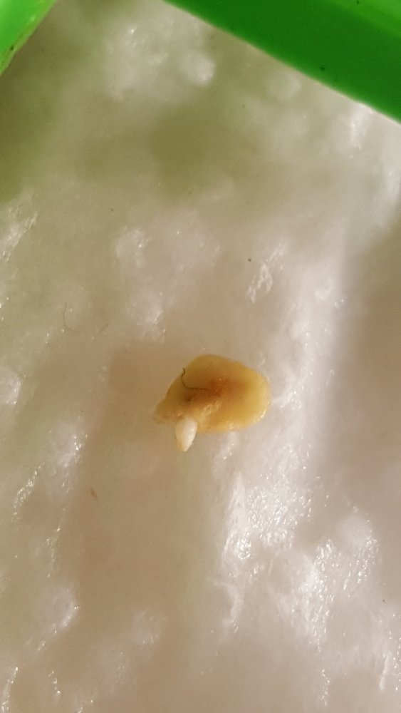Rachenreibe